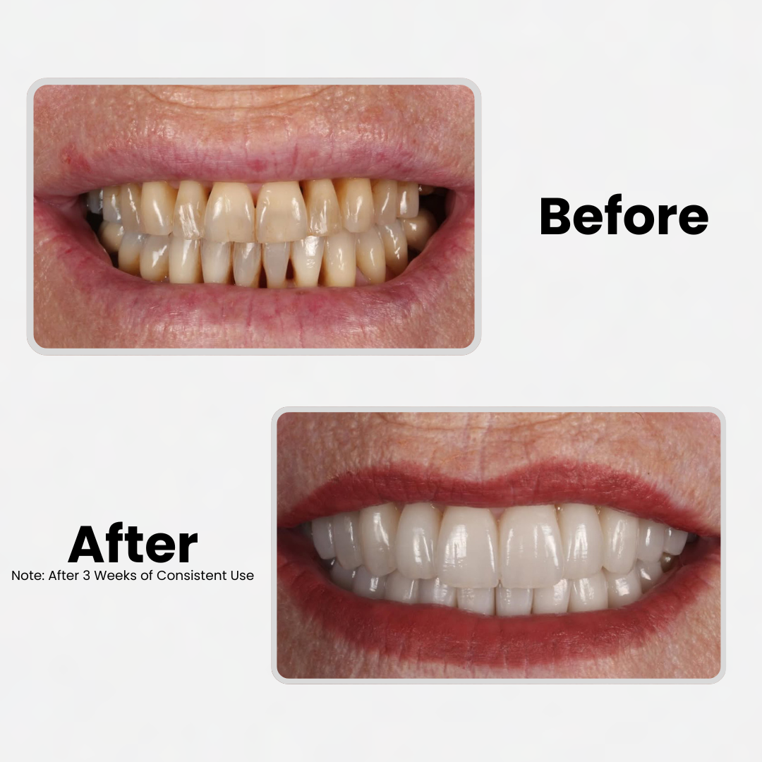 Detoxify™ Restorative SP-6 Probiotic Toothpaste
