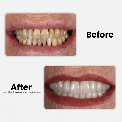 Detoxify™ Restorative SP-6 Probiotic Toothpaste