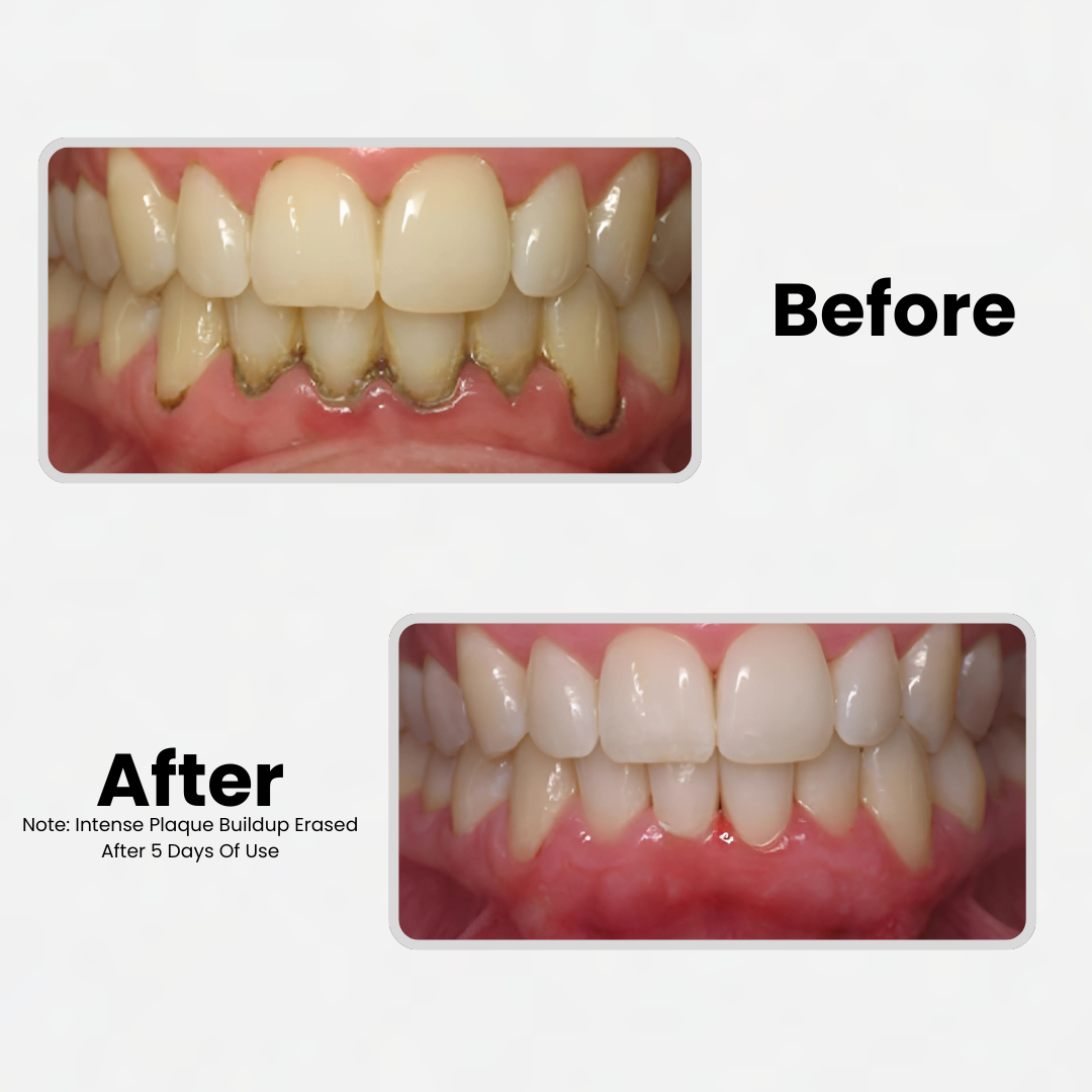 Detoxify™ Restorative SP-6 Probiotic Toothpaste